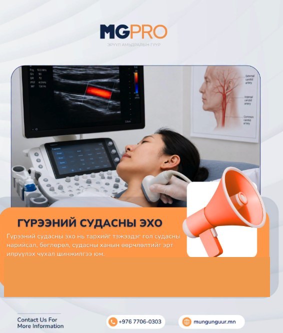 Гүрээний судасны эхо